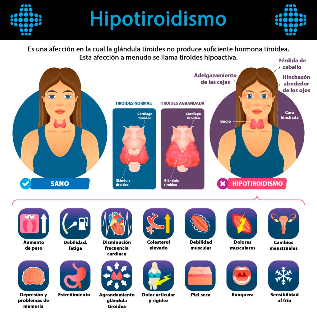 Infografías De Salud Noticias En Salud