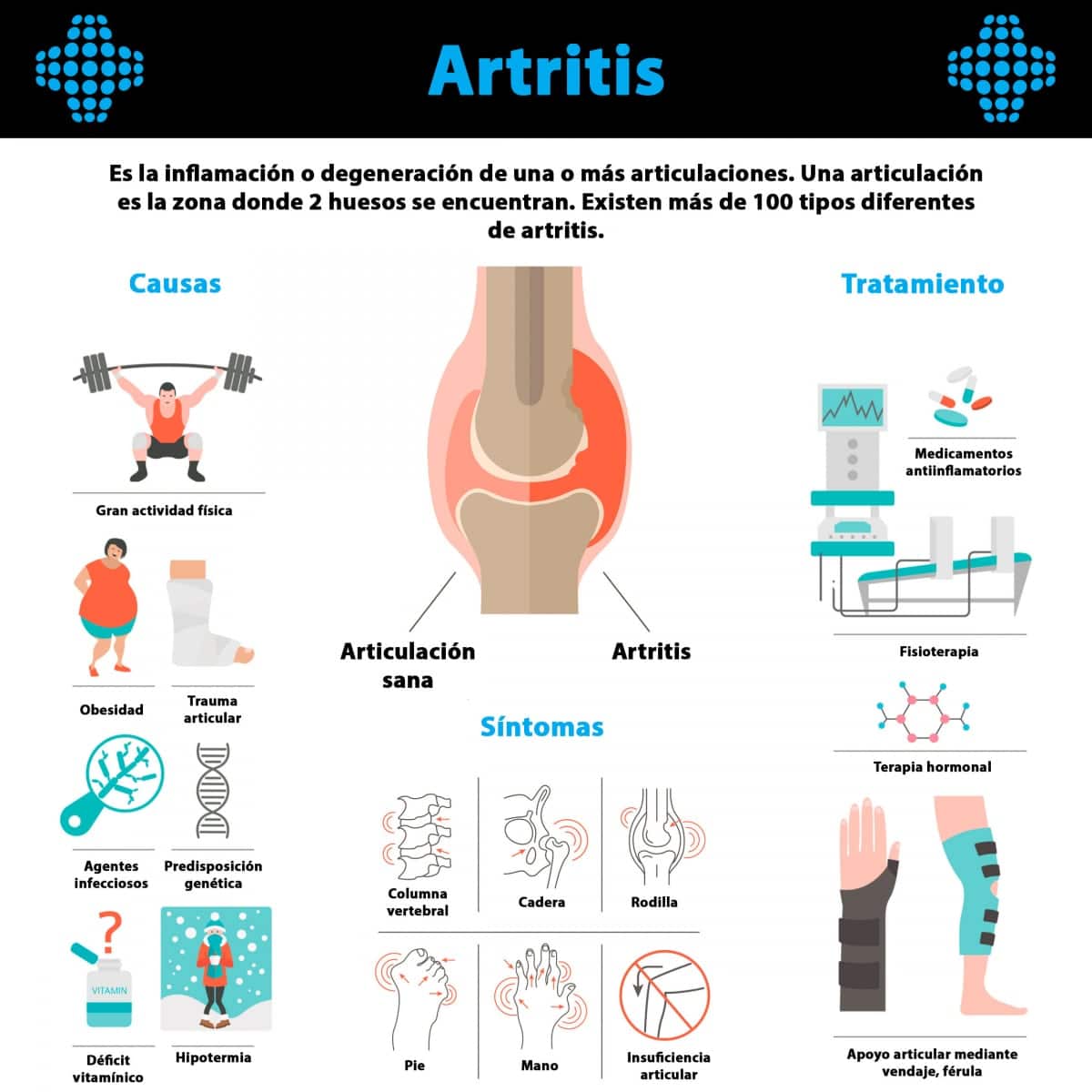 La Artritis