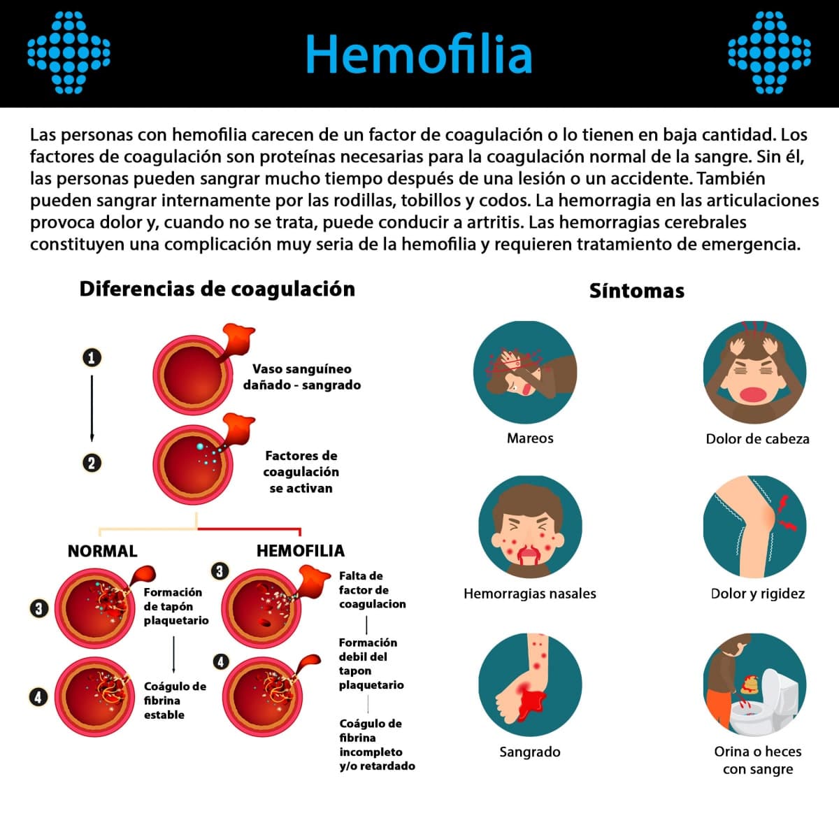 La Hemofilia, causas y diferencias