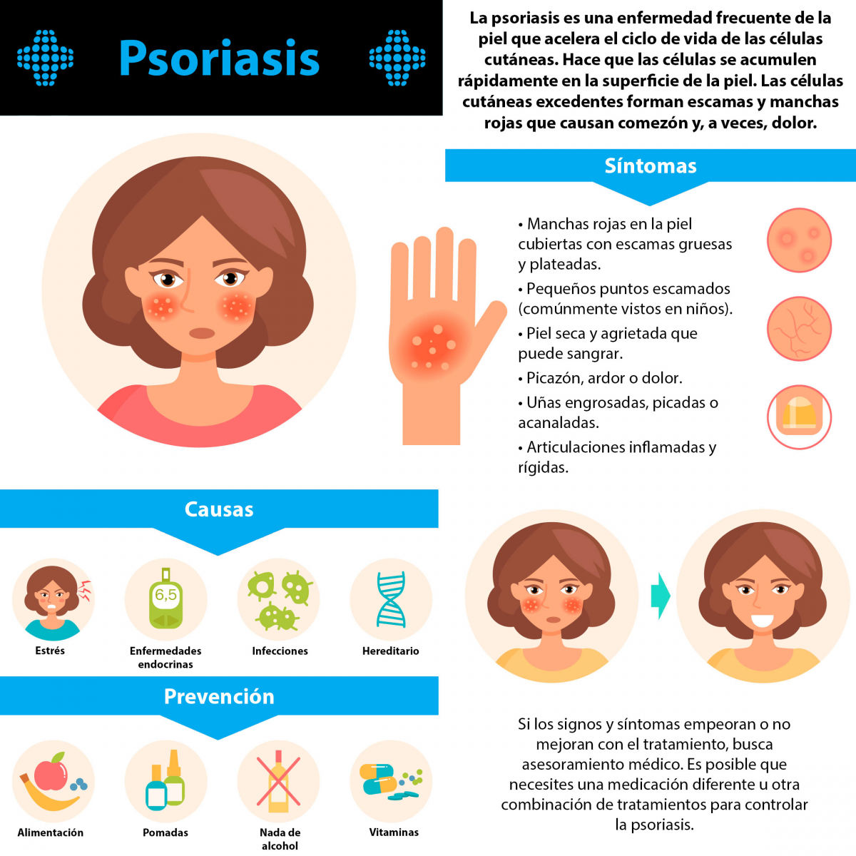 La psoriasis