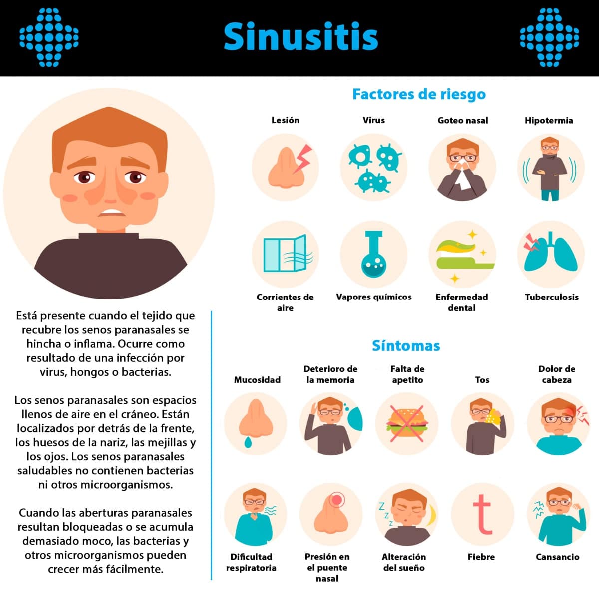 La Sinusitis