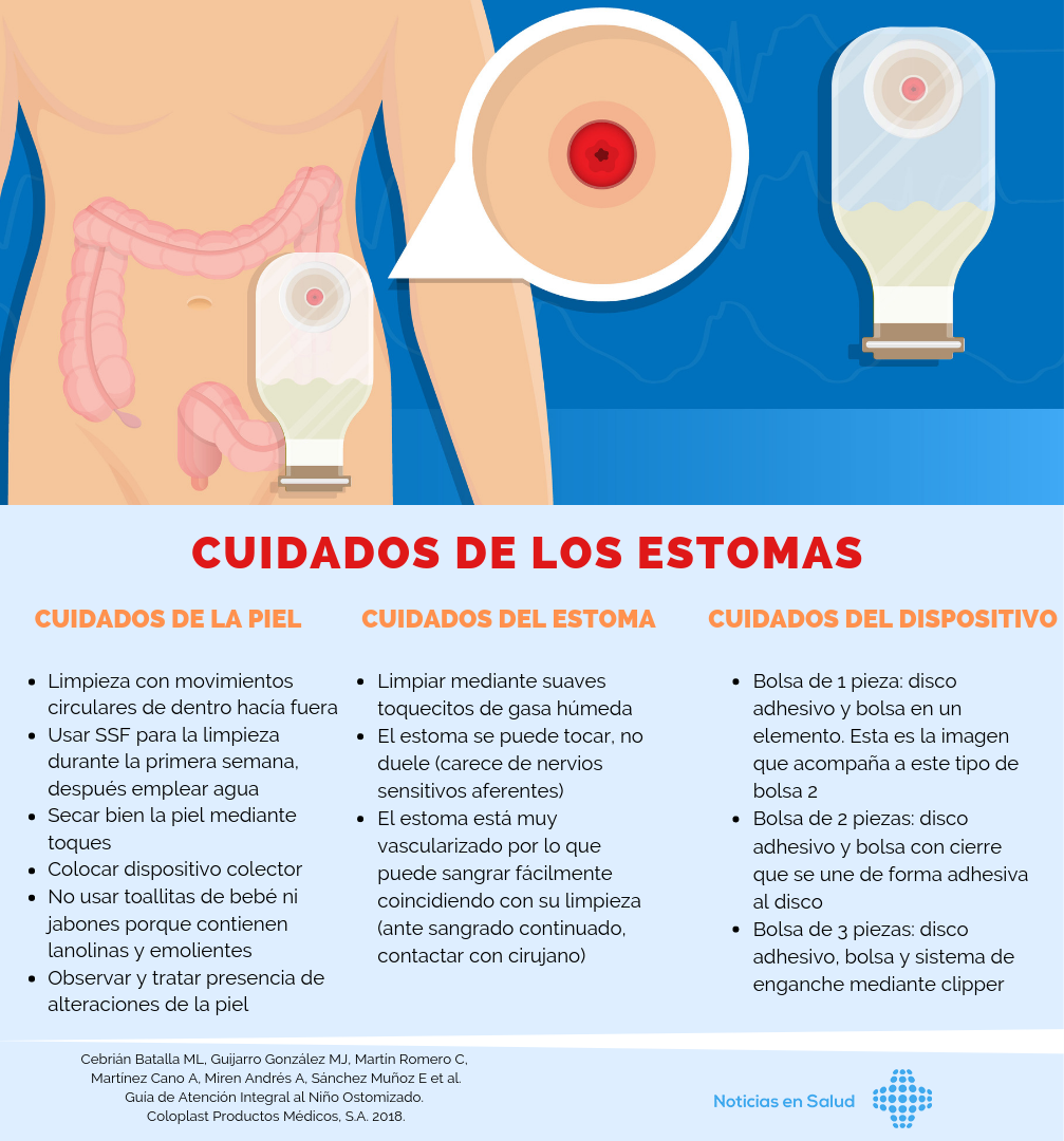 Cuidados de los estomas [Infografía]