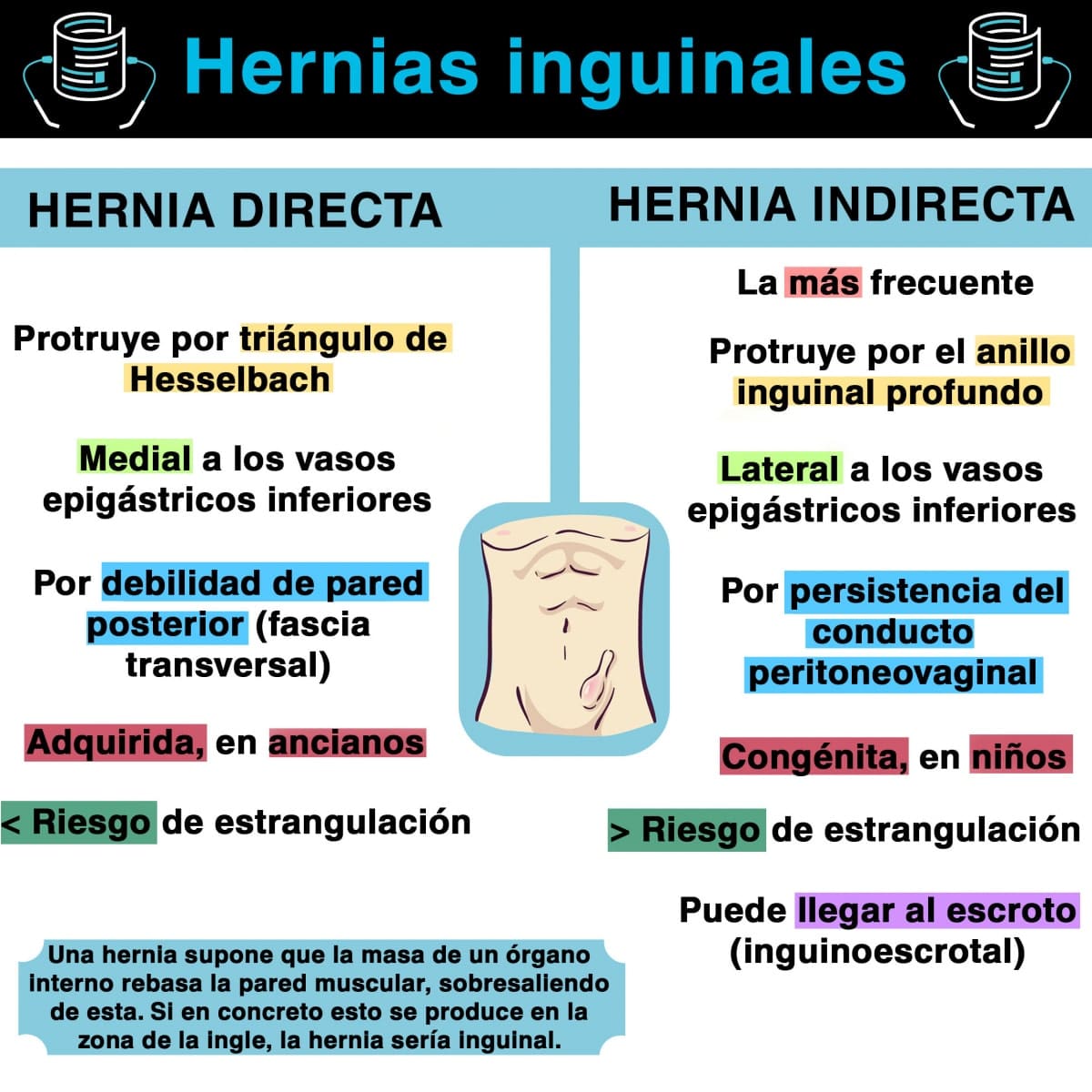 Tipos de hernias inguinales