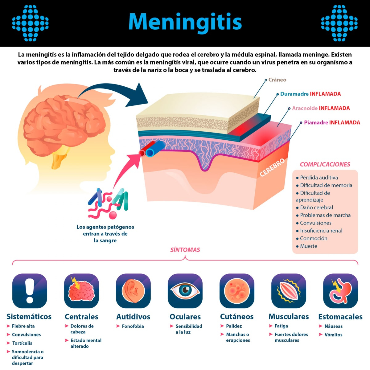 ¿Qué es la meningitis?