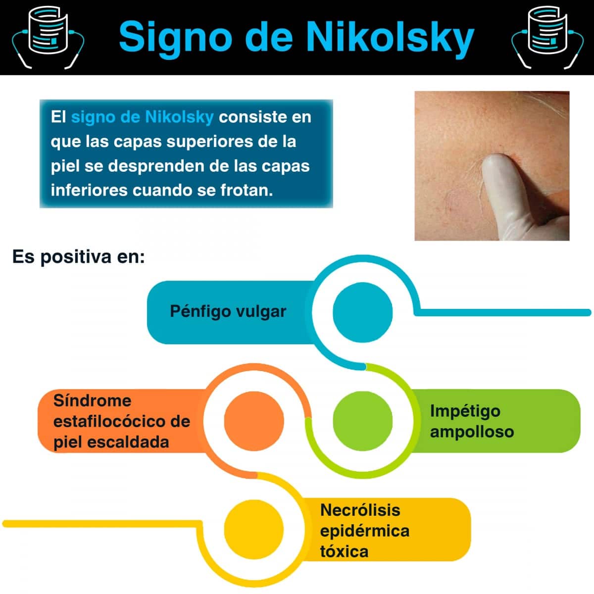 ¿Conoces el Signo de Nikolsky?