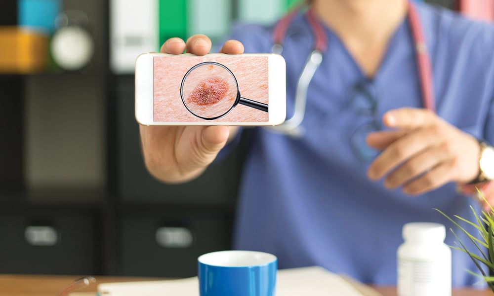 Las apps que detectan cáncer en la piel