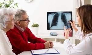 Nuevas vías mejoran el abordaje del paciente con cáncer de pulmón