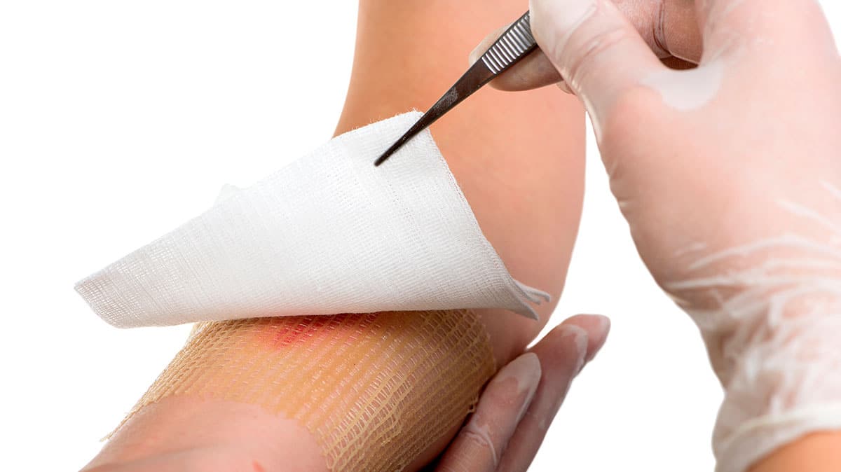 El material de vendaje que ayuda a parar la hemorragia sin adherirse a la herida