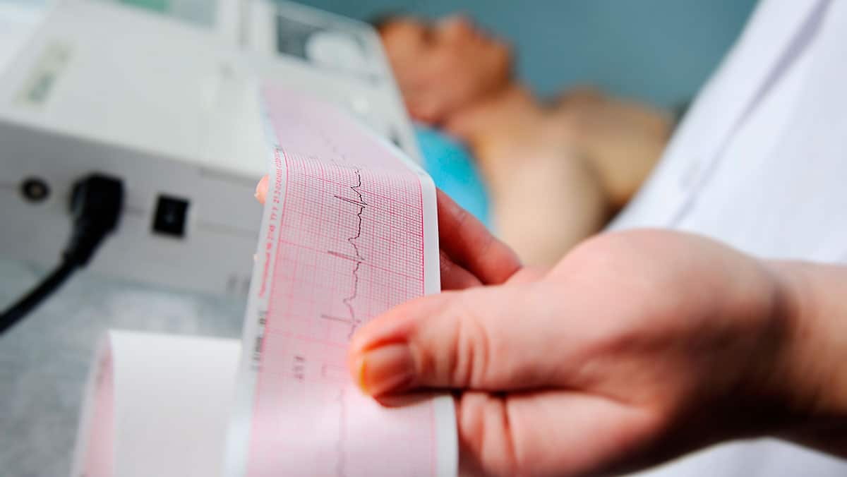 Consiguen detectar niveles bajos de glucosa a través de un ECG sin necesidad de pinchar un dedo