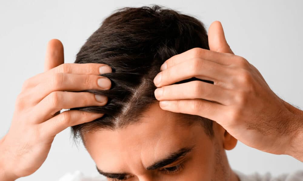 Best hair transplant clinic for alopecia
