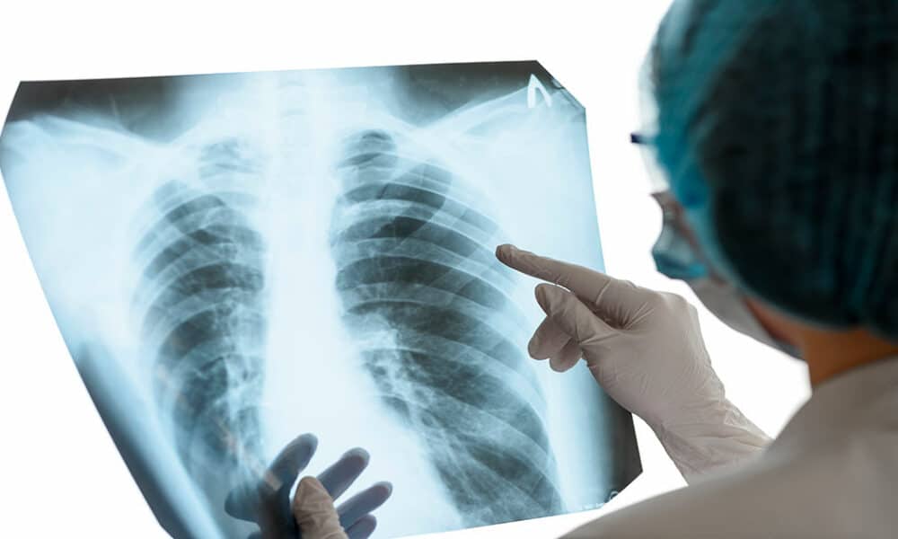 Bruselas desarrolla una plataforma digital para la investigación y tratamiento del cáncer mediante Inteligencia Artificial thumbnail