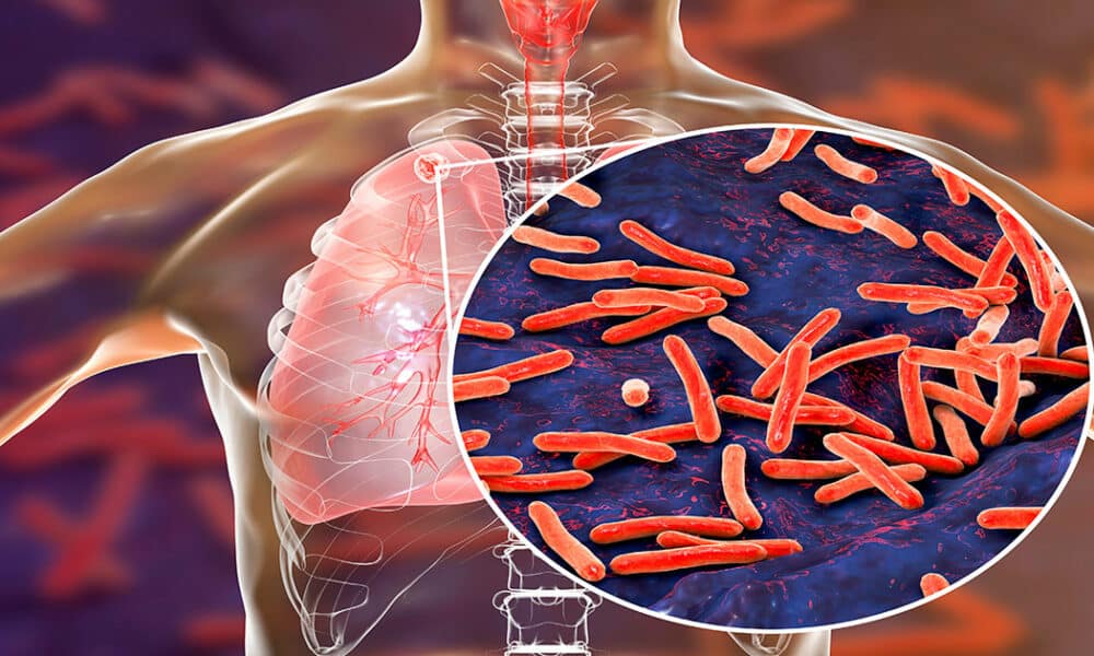 The Spanish tuberculosis vaccine makes history and enters Phase 3