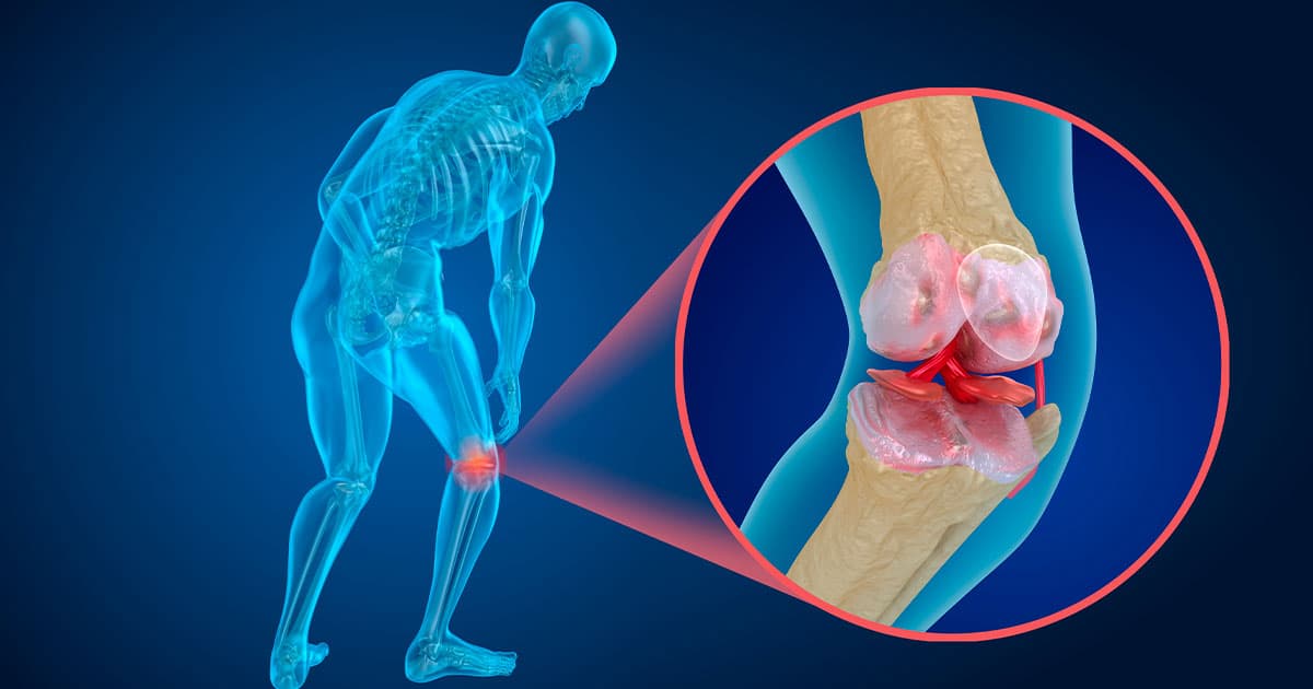 osteoporosis