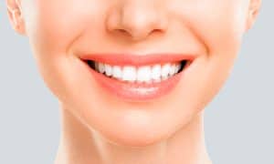 Blanqueamiento dental