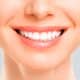 Blanqueamiento dental