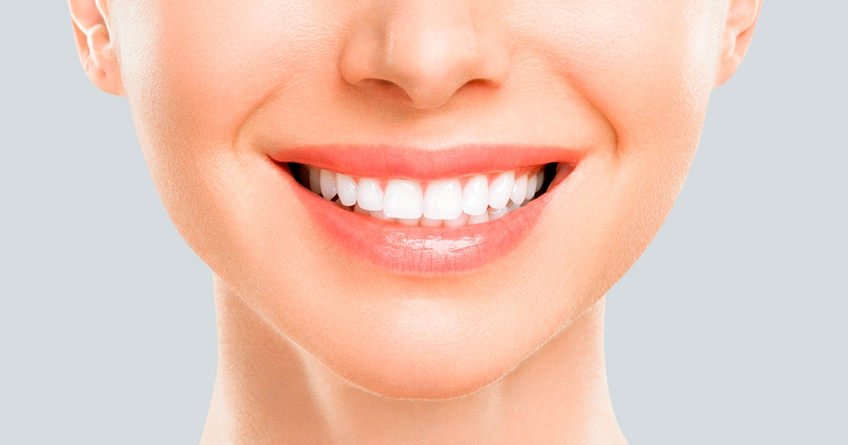 Blanqueamiento dental