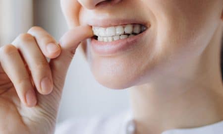 Ortodoncia invisible Dentin